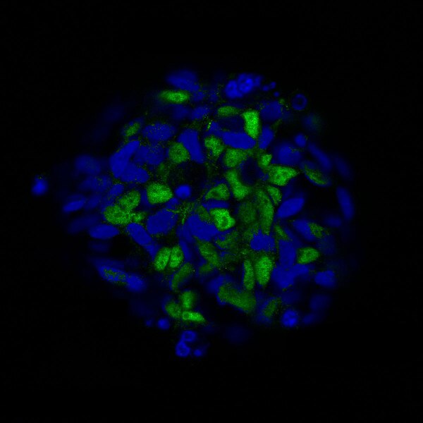 IF of induced neural plate stem cells labeled with DSHB antibody PCRP-ZIC1-1E3 against ZIC1 (green). Image credit: Marc Thier, HI-STEM.